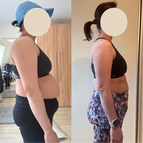 Client before and after: front view, slimmer waist