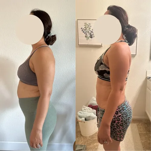 Client before and after: side view, flatter stomach