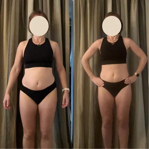 Client before and after: front view, visibly smaller waist