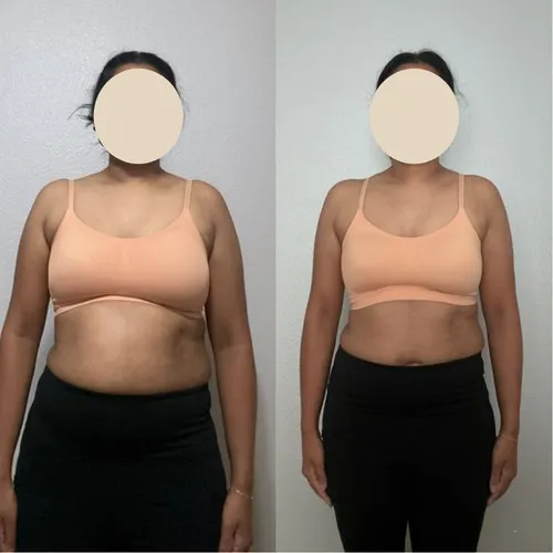 Client before and after: front view in beige sports bra, slimmer waist