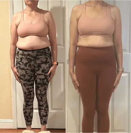 Client before and after: front view in patterned leggings, toned midsection
