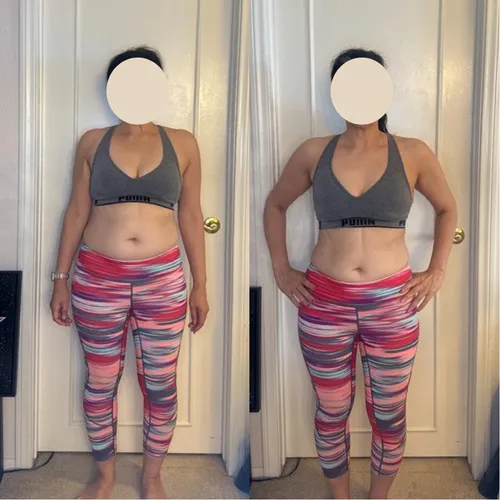 Client before and after: front view in striped leggings