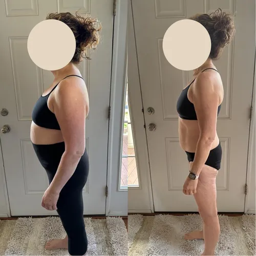 Client before and after: side view, reduced belly