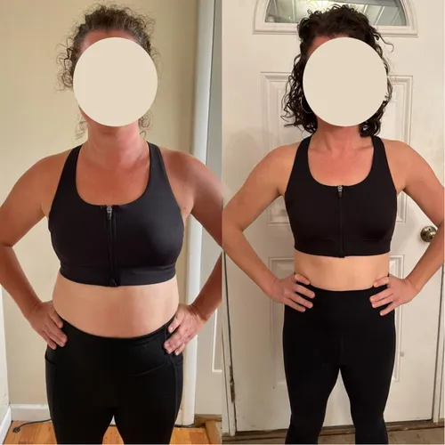 Client before and after: front view, hands on hips