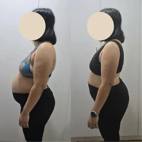 Client before and after: side view in black leggings